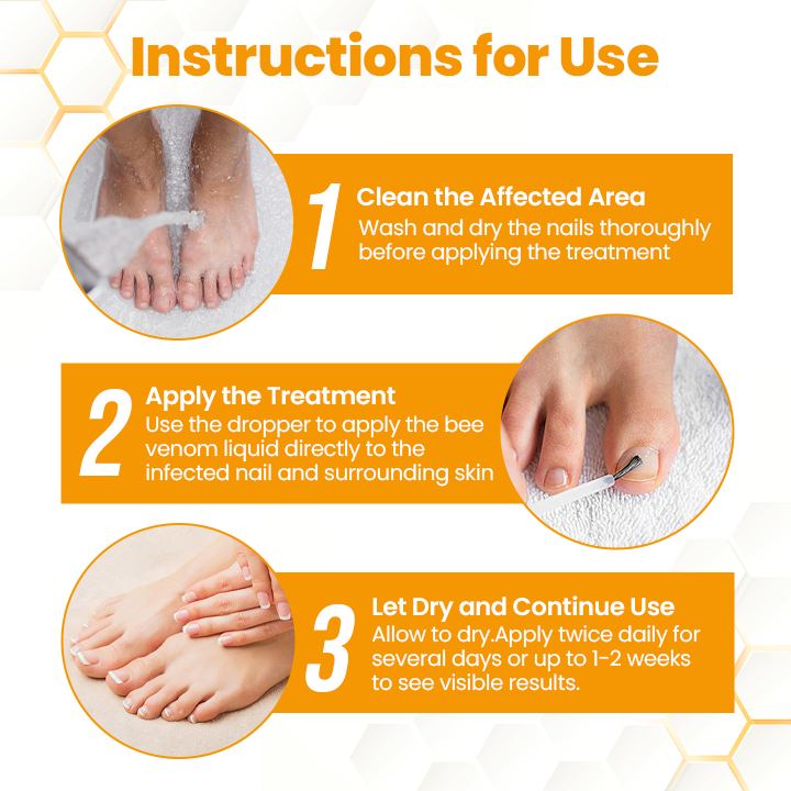 Αντιμυκητιακό Λάδι Αναζωογόνησης Νυχιών με Δηλητήριο Μέλισσας