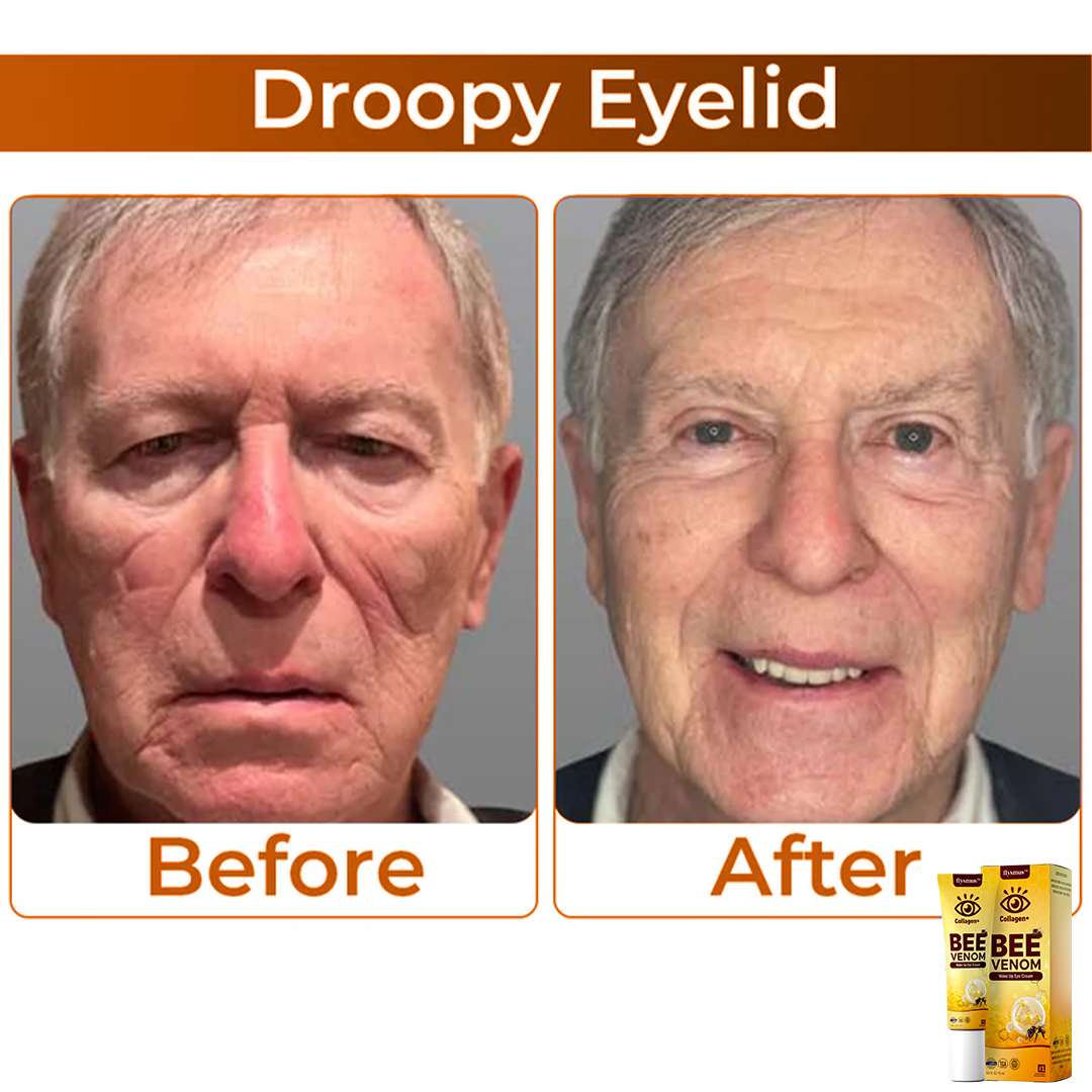 Κρέμα Ματιών με Δηλητήριο Μέλισσας για Αντιγήρανση και Ανόρθωση