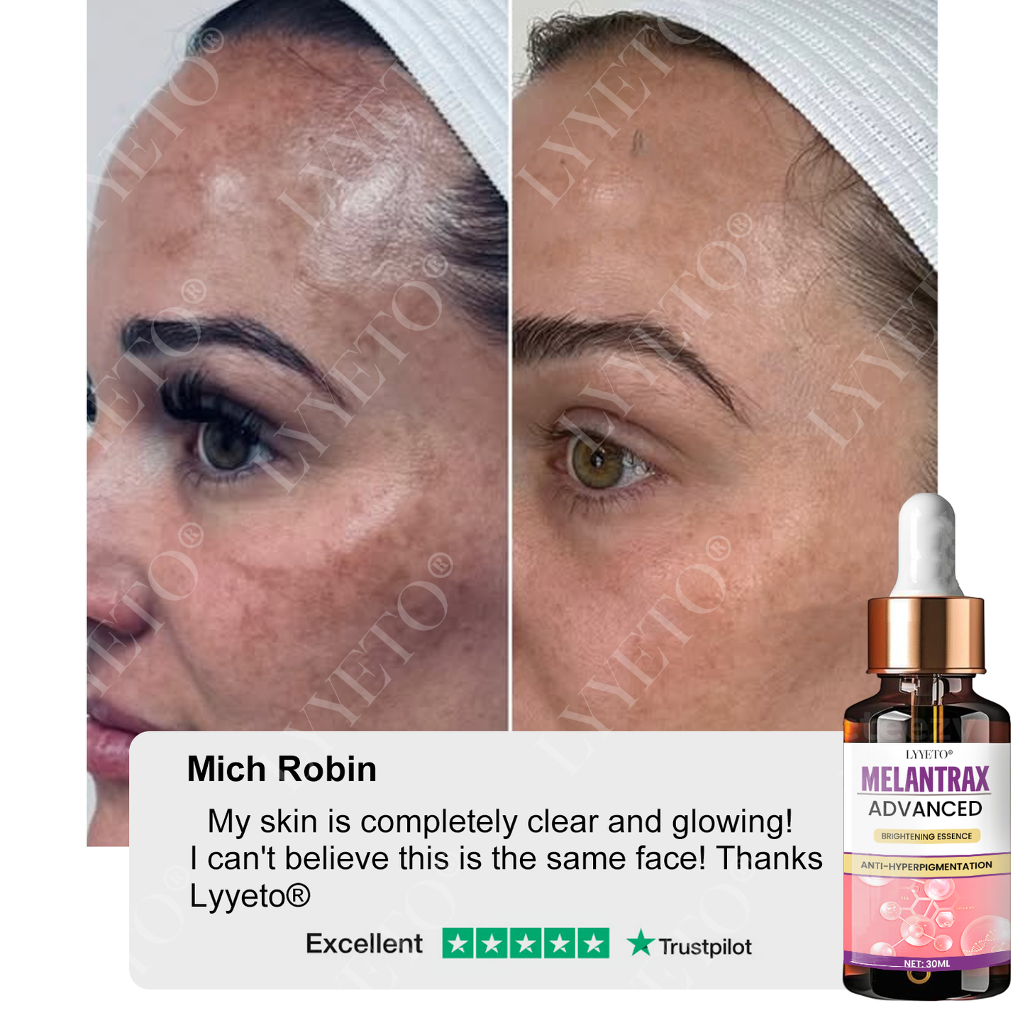 Προηγμένο Λευκαντικό Serum ACE