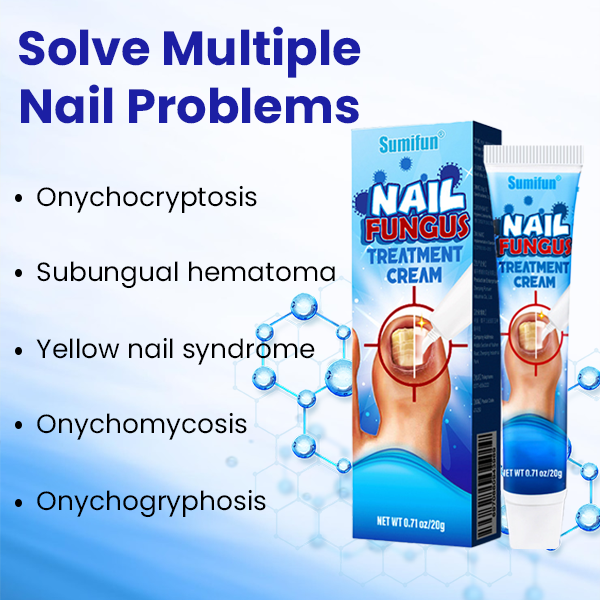 ✨ Επίσημο Κατάστημα | Timilk® Αντιμυκητιακή Κρέμα Νυχιών 🦶 Ξεφορτώσου Μύκητες, Οσμές & Ασχήμια — Οριστικά.