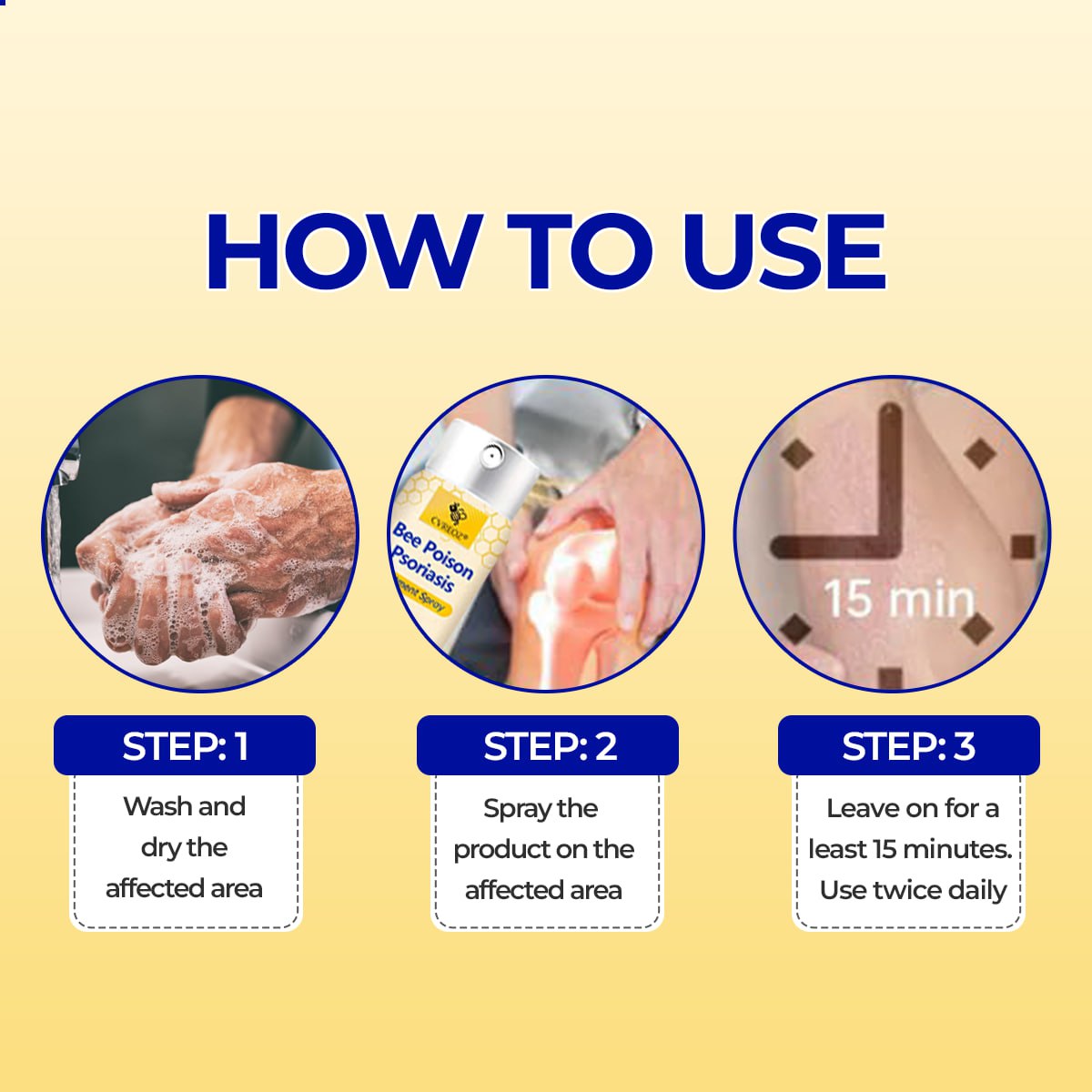 Σπρέι Θεραπείας Ψωρίασης με Δηλητήριο Μέλισσας