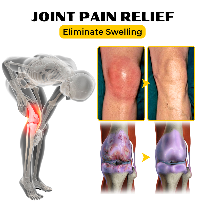 Κρέμα Ανακούφισης με Δηλητήριο Μέλισσας