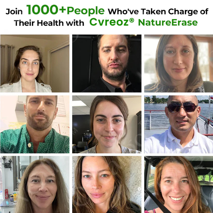 Άμεση Κρέμα για Ελιές & Κηλίδες NatureErase