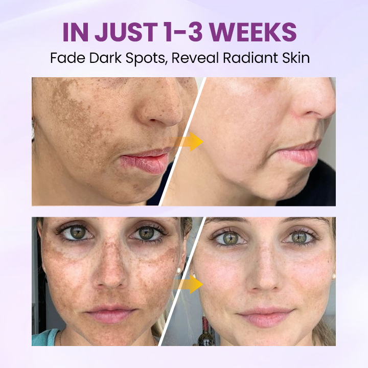 Ορός Λάμψης και Καθαρισμού Δέρματος