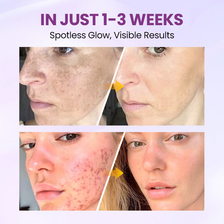 Ορός Λάμψης και Καθαρισμού Δέρματος