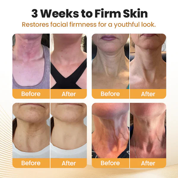 Στικ Σύσφιξης Λαιμού BeeLixir