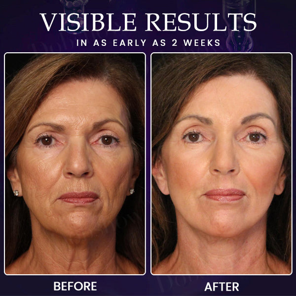 Κρέμα Σύσφιξης LuxeYouth