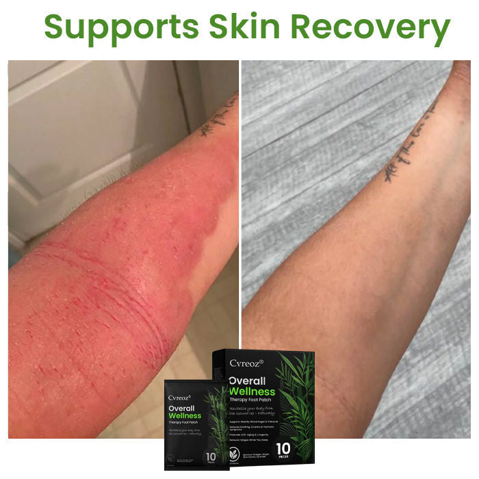 Επιθέματα Ευεξίας & Αποτοξίνωσης Πελμάτων