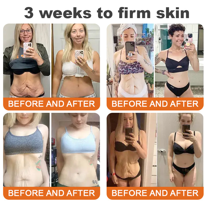 Στικ Σύσφιξης με Δηλητήριο Μέλισσας και Εφέ Botox