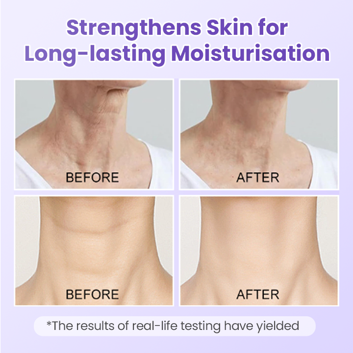 Αντιρυτιδικό Επίθεμα Λαιμού με Πεπτίδια