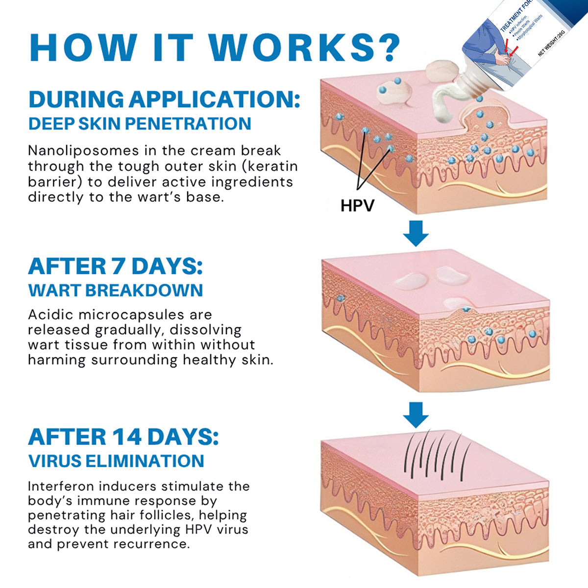 Κρέμα για Κονδυλώματα Γεννητικών Οργάνων