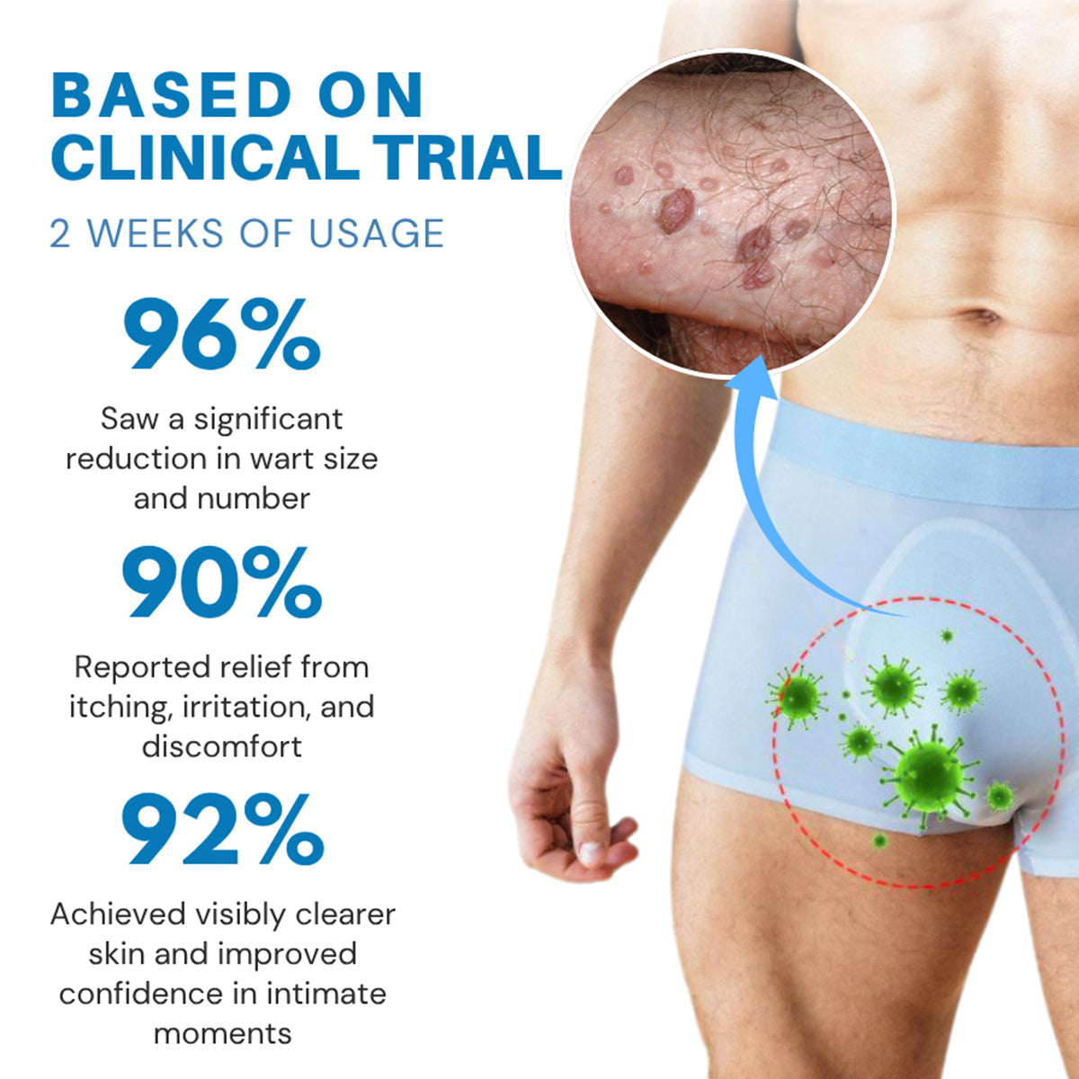 Κρέμα για Κονδυλώματα Γεννητικών Οργάνων