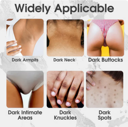 SnowBleach™  Λευκαντική Κρέμα Σώματος