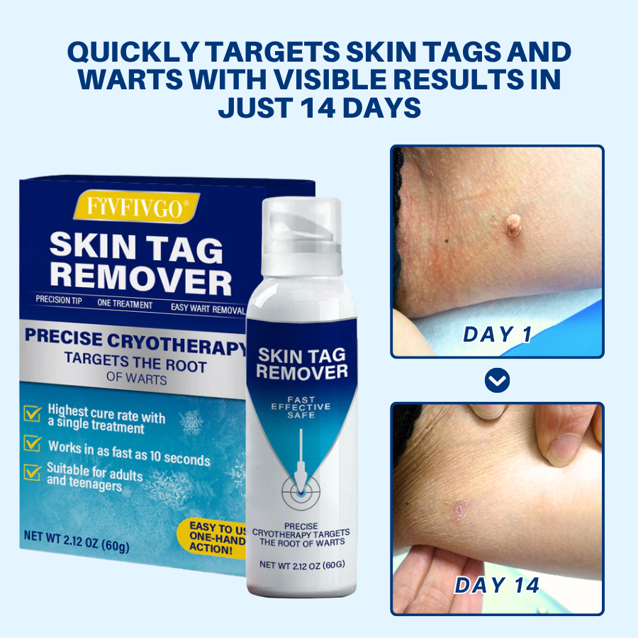 Σπρέι Αφαίρεσης Δερματικών Θηλωμάτων