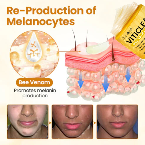 Κρέμα Φωτεινότητας & Ανάπλασης για Λεύκη