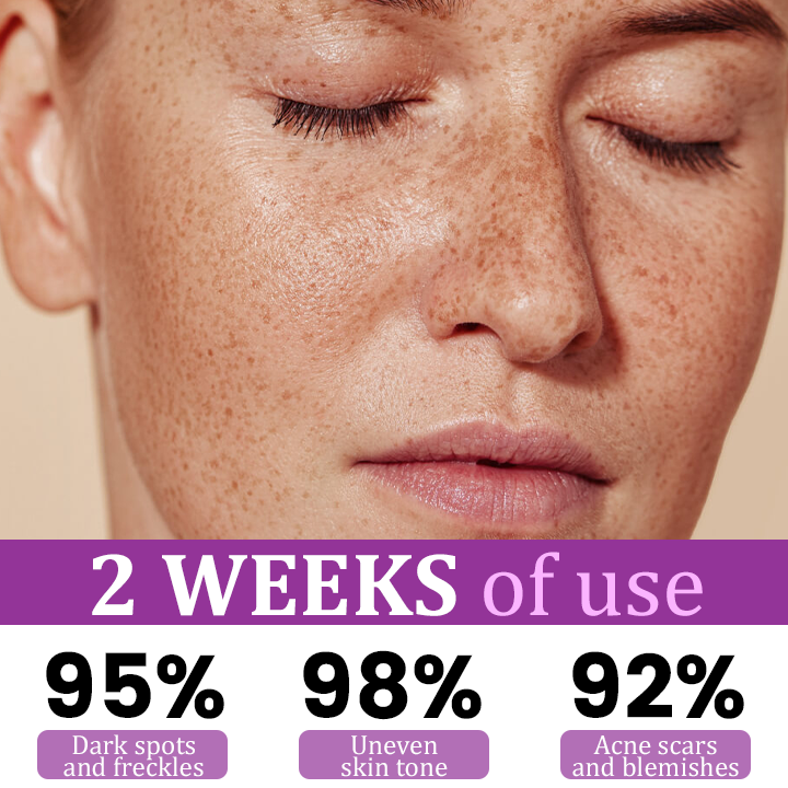 Ορός Εντατικής Αντιμετώπισης Της Υπερμελάγχρωσης