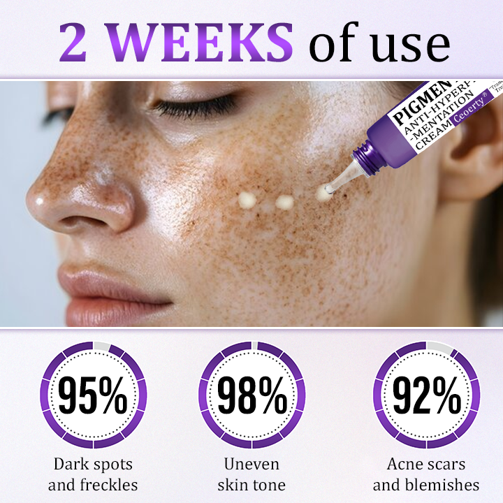 Κρέμα Κατά της Υπερμελάγχρωσης