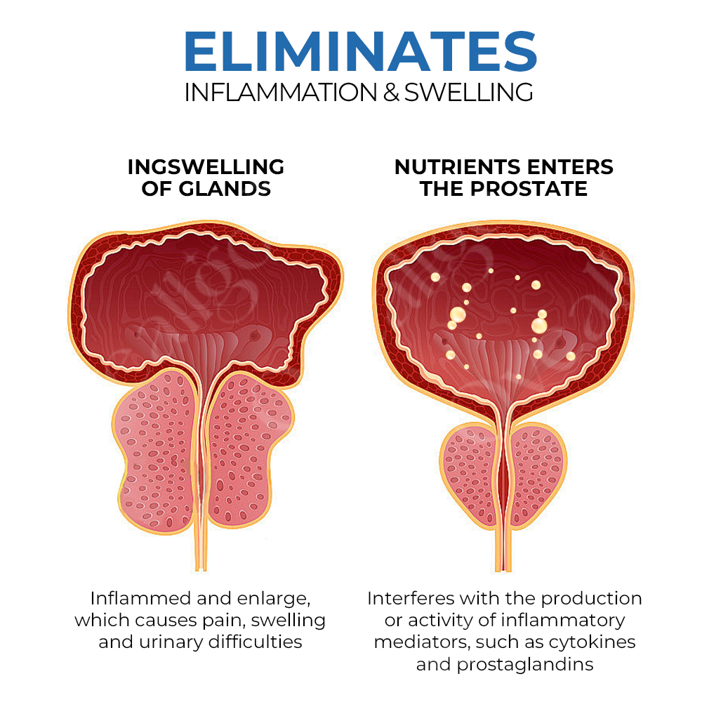 Ρινική Συσκευή Εισπνοής για την Ευεξία του Προστάτη BeeBoom