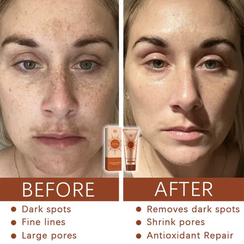 Φυτική Μάσκα Προσώπου για Κηλίδες