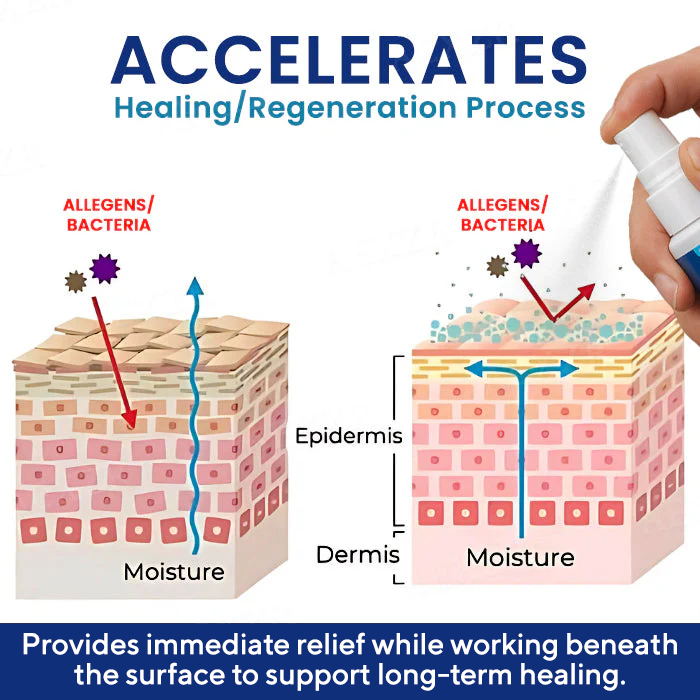 Σπρέι Ανακούφισης Ερεθισμών Γεννητικών Οργάνων