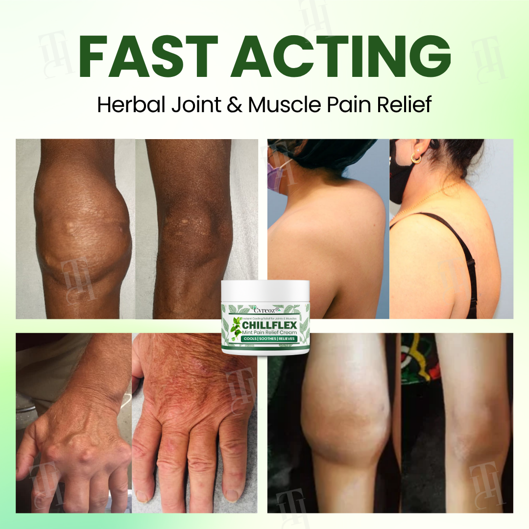 Αναπλαστική Κρέμα Κατά Του Πόνου Με Μέντα