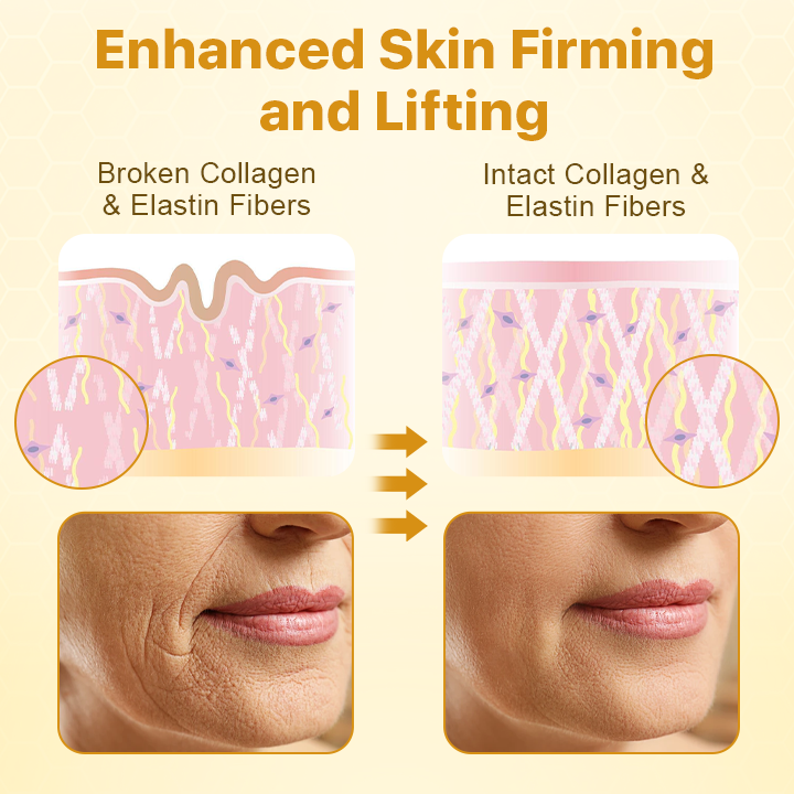 Κρέμα Ανόρθωσης με Δηλητήριο Μέλισσας ΜπότοξΛαξ