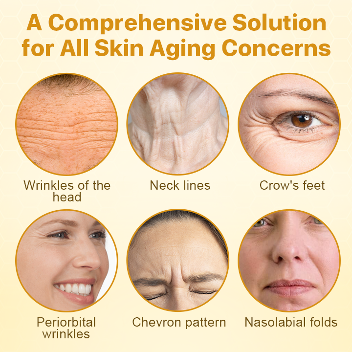 Κρέμα Ανόρθωσης με Δηλητήριο Μέλισσας ΜπότοξΛαξ