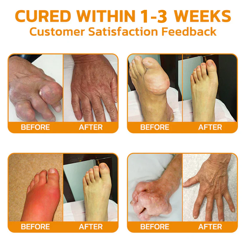 Κρέμα Ανακούφισης Πόνου & Επούλωσης Οστών με Δηλητήριο Μέλισσας