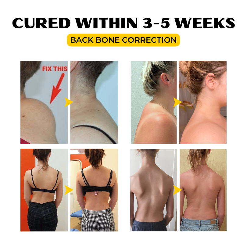 Κρέμα Ανακούφισης με Δηλητήριο Μέλισσας