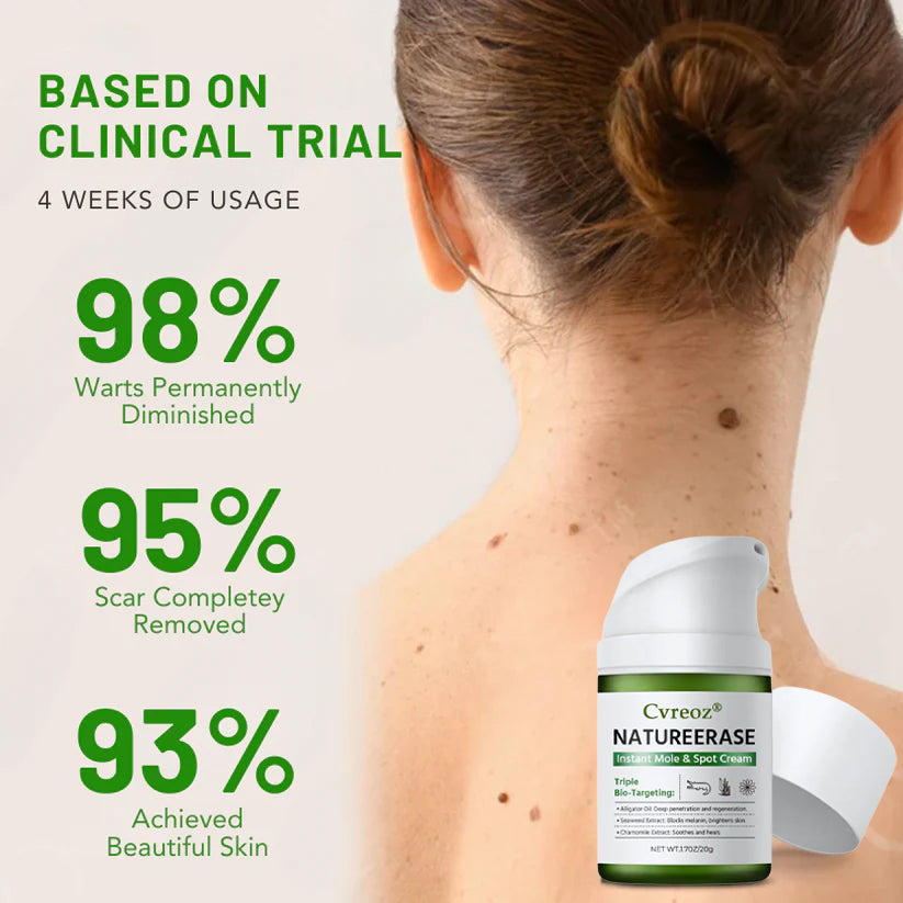 Άμεση Κρέμα για Ελιές & Κηλίδες NatureErase