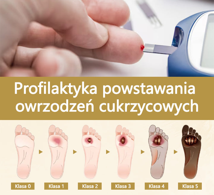 Διαβητικό Σπρέι Ποδιών με Δηλητήριο Μέλισσας