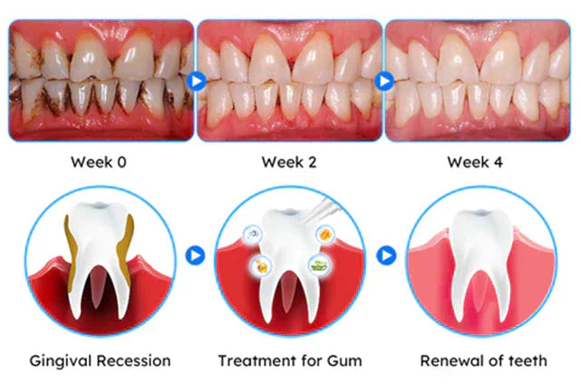 Τζελ θεραπείας ούλων !