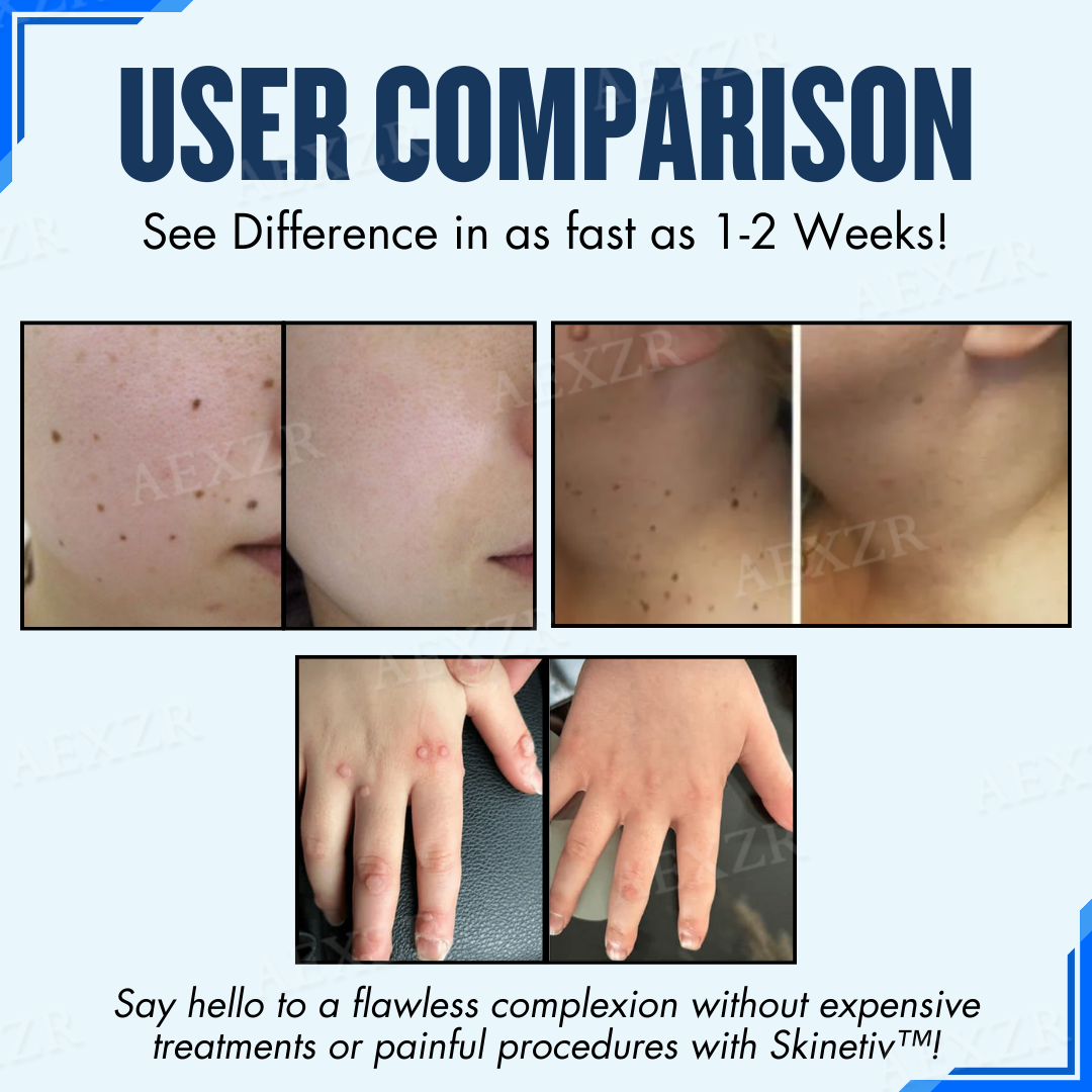 Αυτοκόλλητα Αφαίρεσης Σπιλών, Κονδυλωμάτων & Κρεατοελιών του Δέρματος