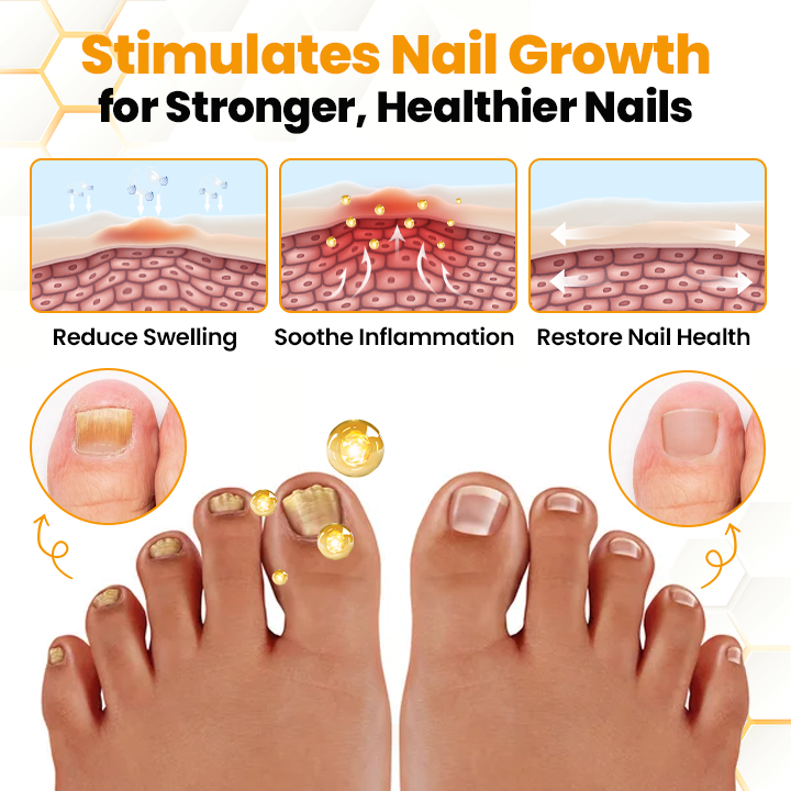 Αντιμυκητιακό Λάδι Αναζωογόνησης Νυχιών με Δηλητήριο Μέλισσας