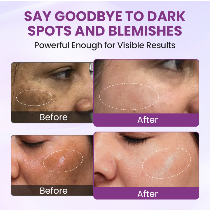 Ορός Λάμψης και Καθαρισμού Δέρματος