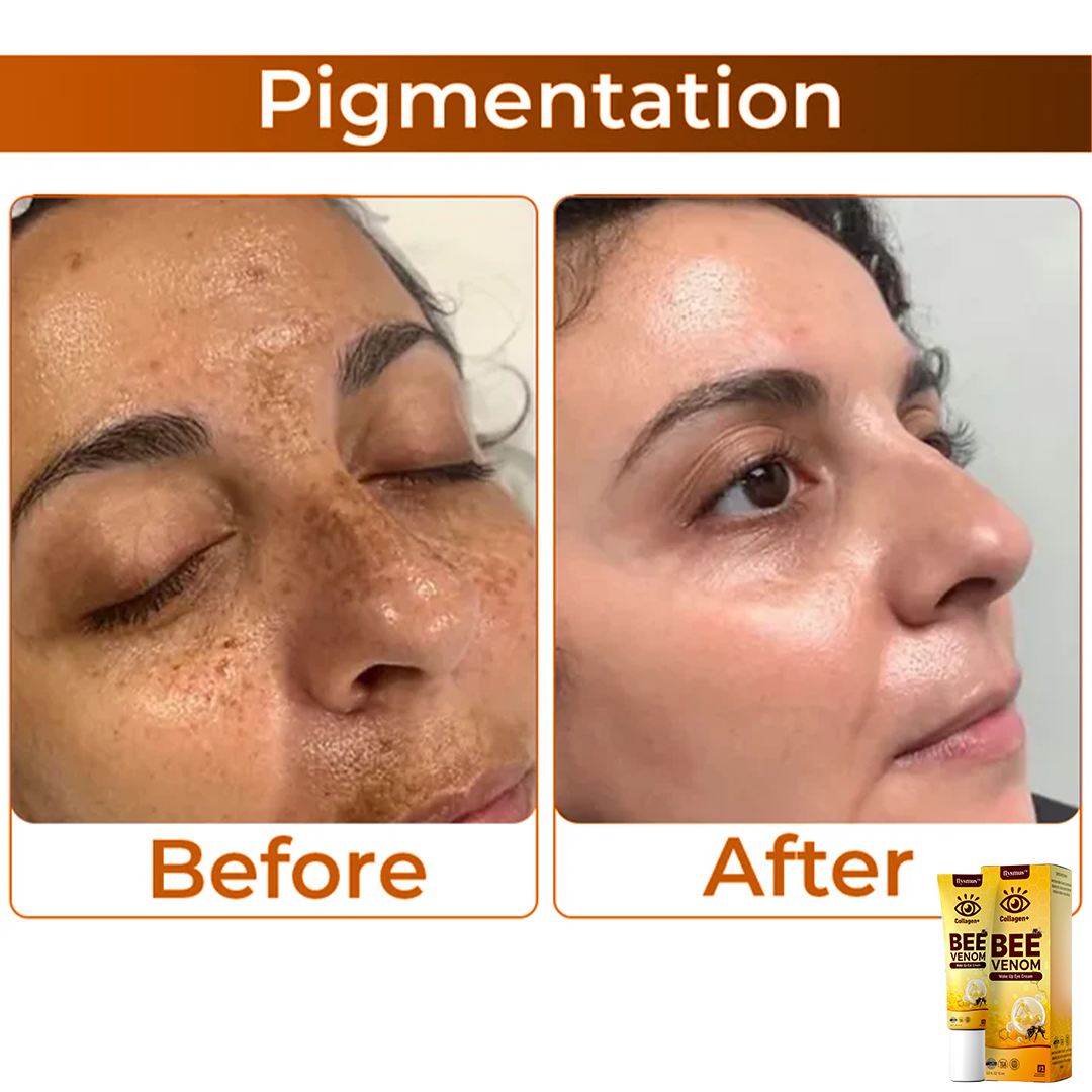 Κρέμα Ματιών με Δηλητήριο Μέλισσας για Αντιγήρανση και Ανόρθωση
