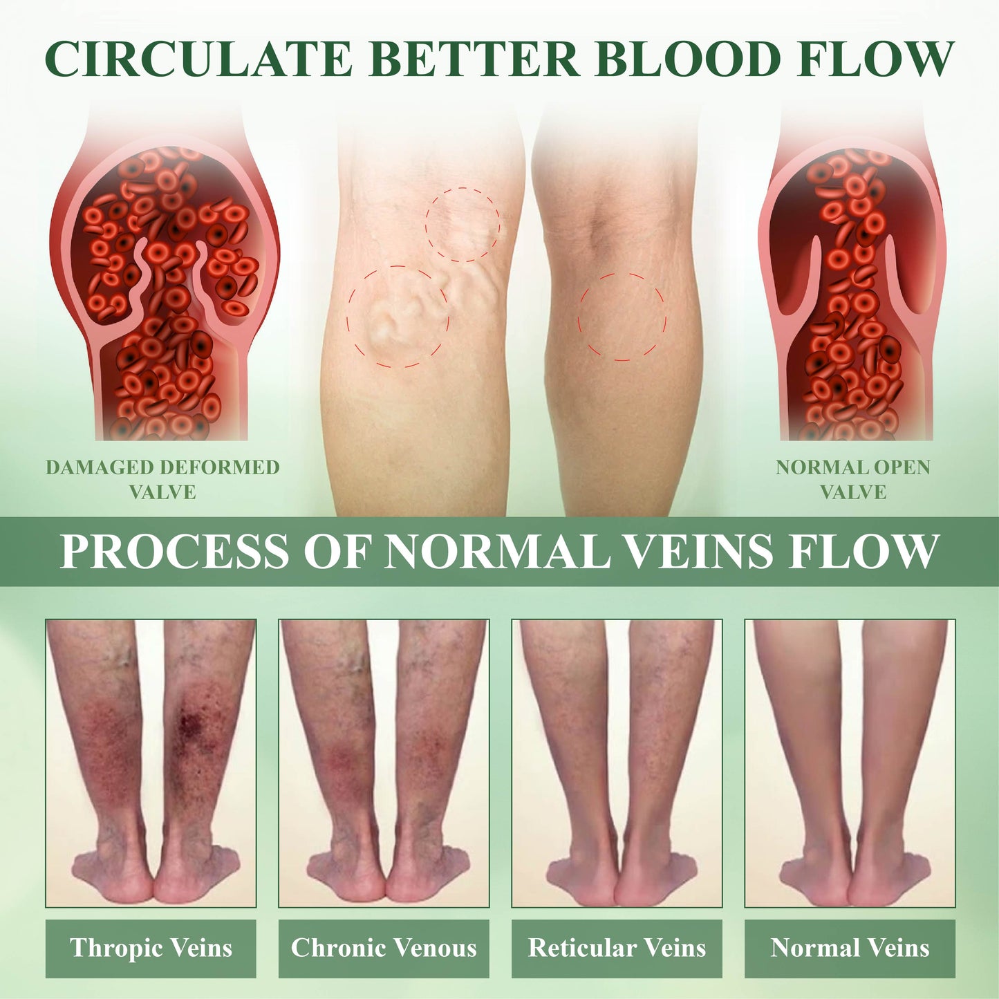 CircuHerb Βάλσαμο Καταπράυνσης & Επούλωσης για Οίδημα
