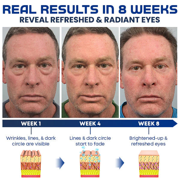 Κρέμες Ματιών Για Άμεση Ενυδάτωση, Επανόρθωση & Αναζωογόνηση 🎁
