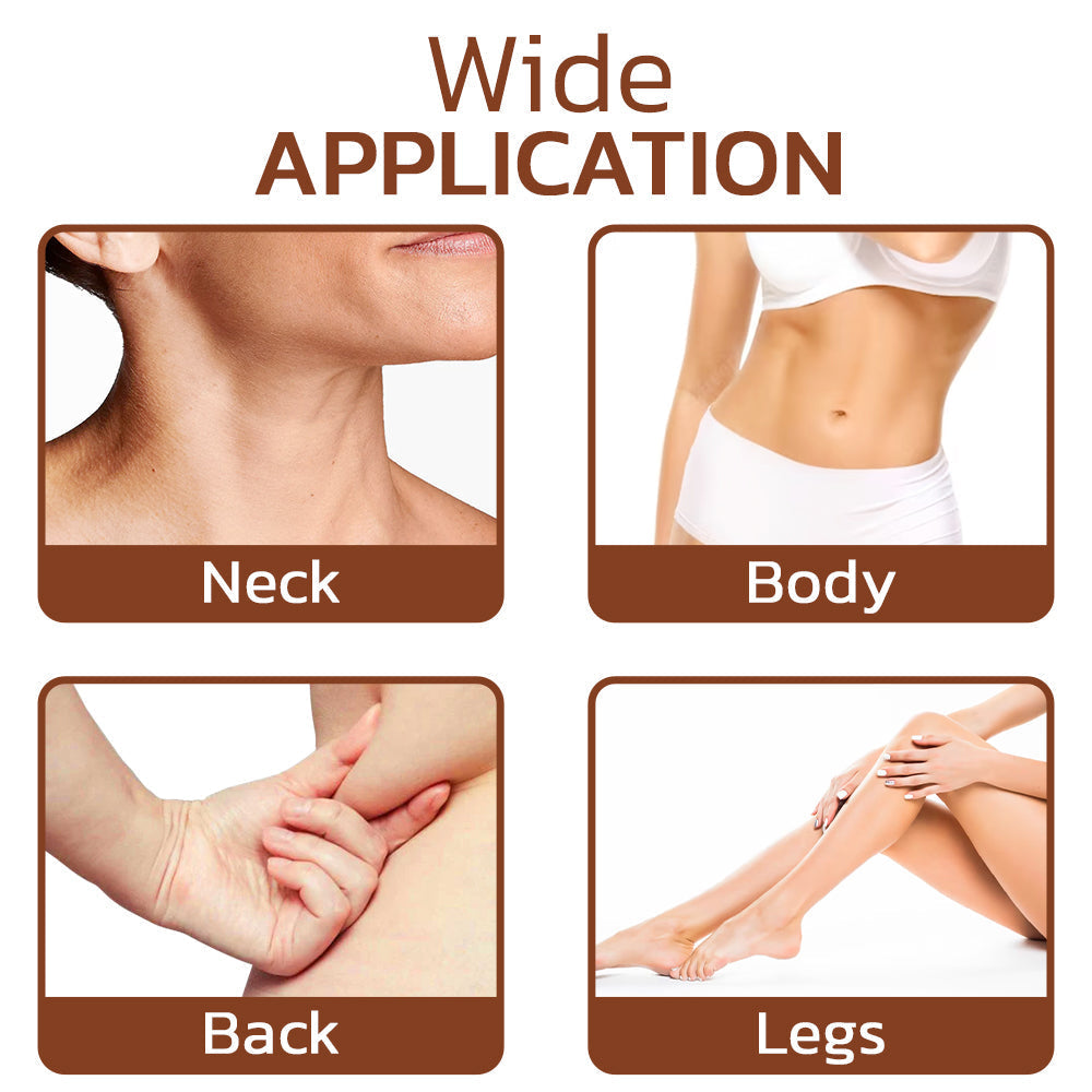 Φυσική Κρέμα κατά των Λιπωμάτων