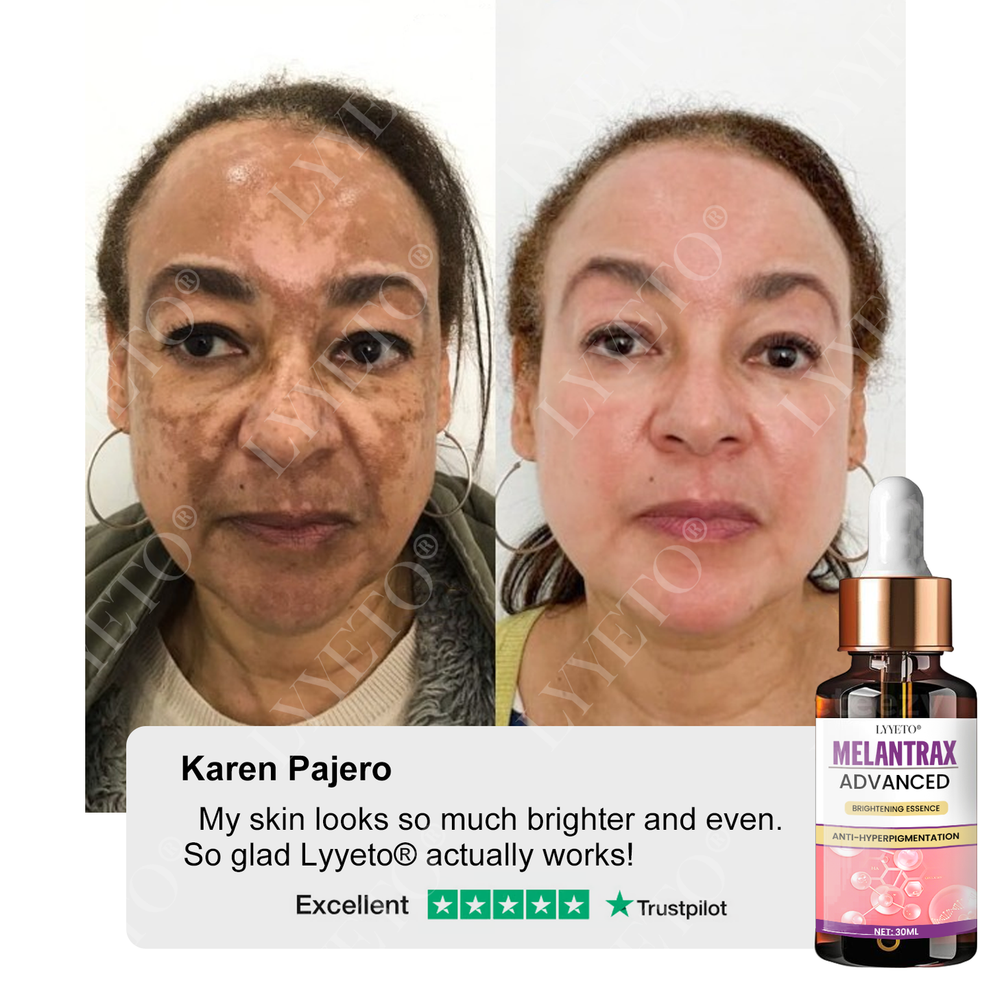 Προηγμένο Λευκαντικό Serum ACE