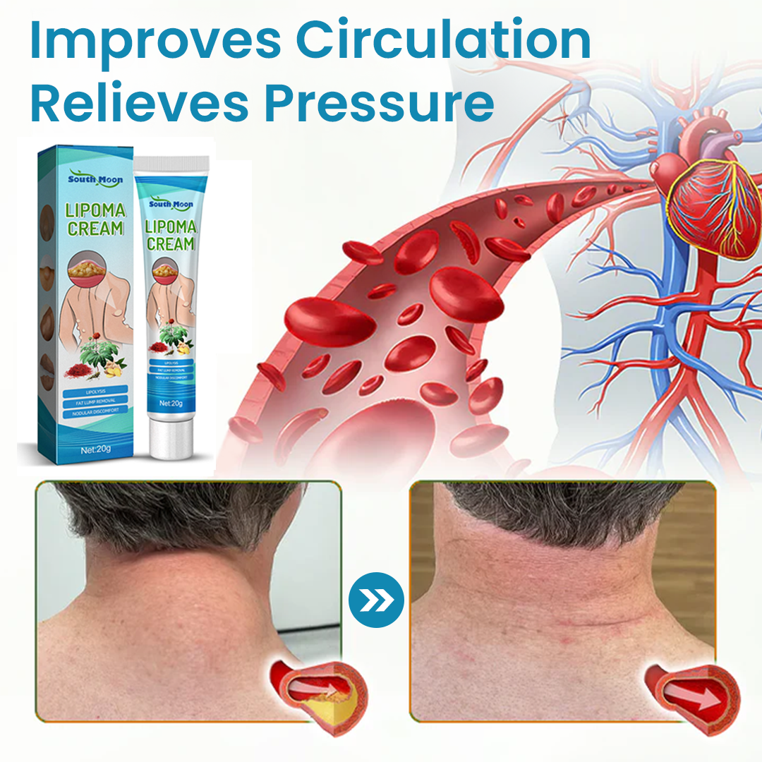 Cvreoz® Κρέμα Αφαίρεσης Λιπώματος