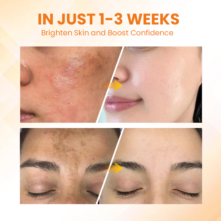 Ορός Λάμψης και Καθαρισμού Δέρματος Των Δυσχρωμιών με Νιασιναμίδη & Βιταμίνη C