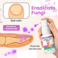 Σπρέι Κατά της Μυκητίασης Νυχιών