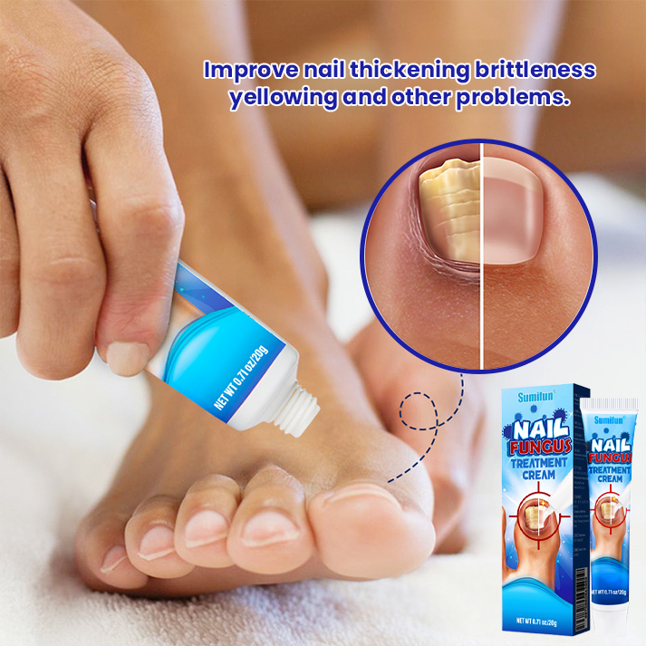 ✨ Επίσημο Κατάστημα | Timilk®  Αντιμυκητιακή Κρέμα Νυχιών 🦶 Ξεφορτώσου Μύκητες, Οσμές & Ασχήμια — Οριστικά.