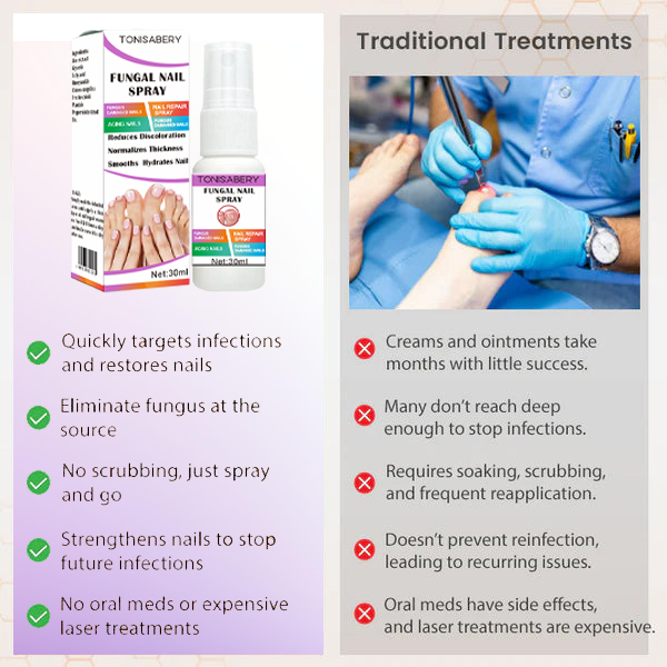 Σπρέι Κατά της Μυκητίασης Νυχιών