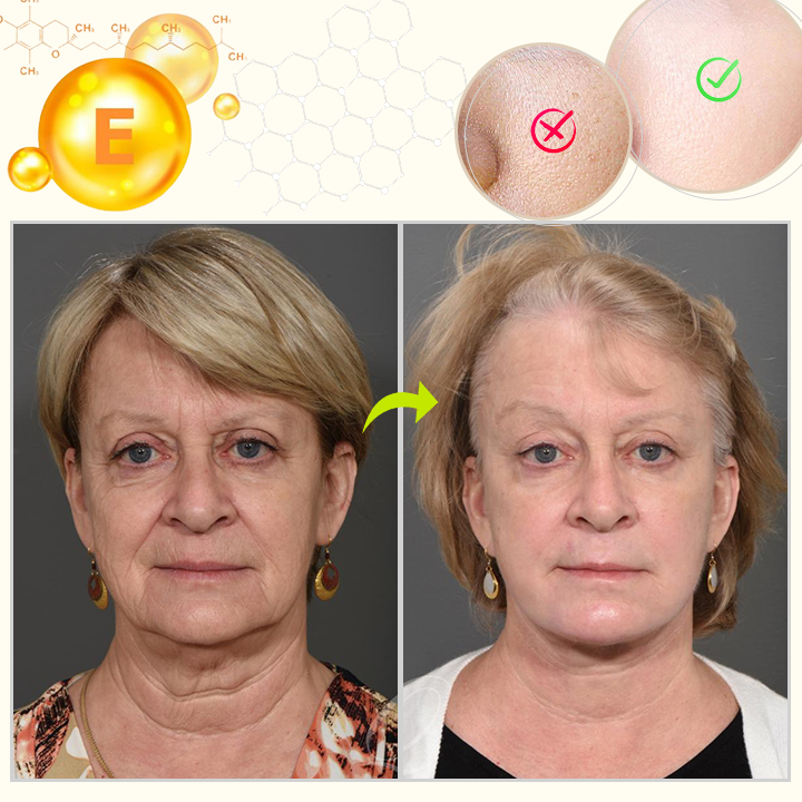 Απόκτησε την Μοναδική μας Προσφορά ✔️ Ορός Προσώπου Με Βιταμίνη Ε Σε Κάψουλες!