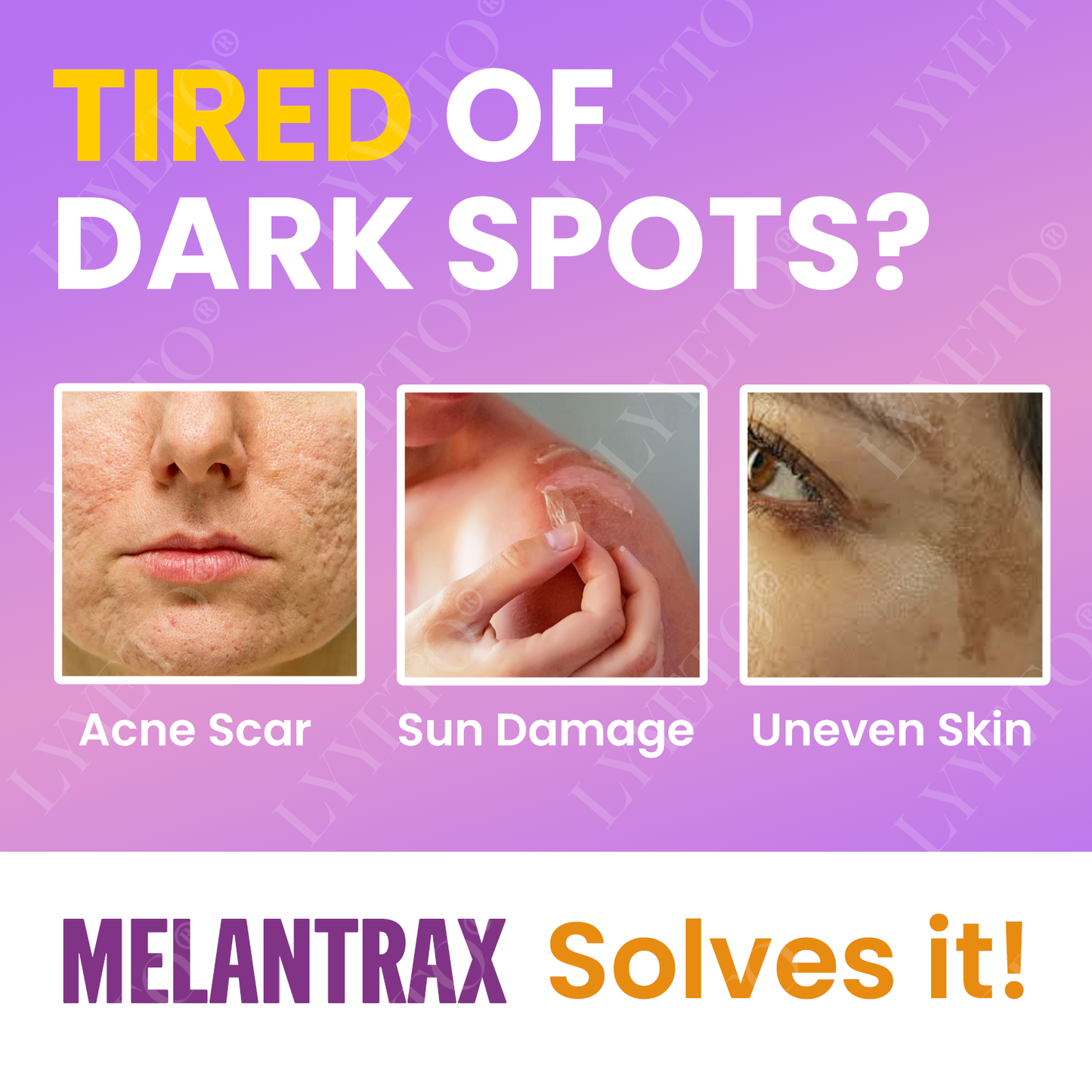 Προηγμένο Λευκαντικό Serum ACE