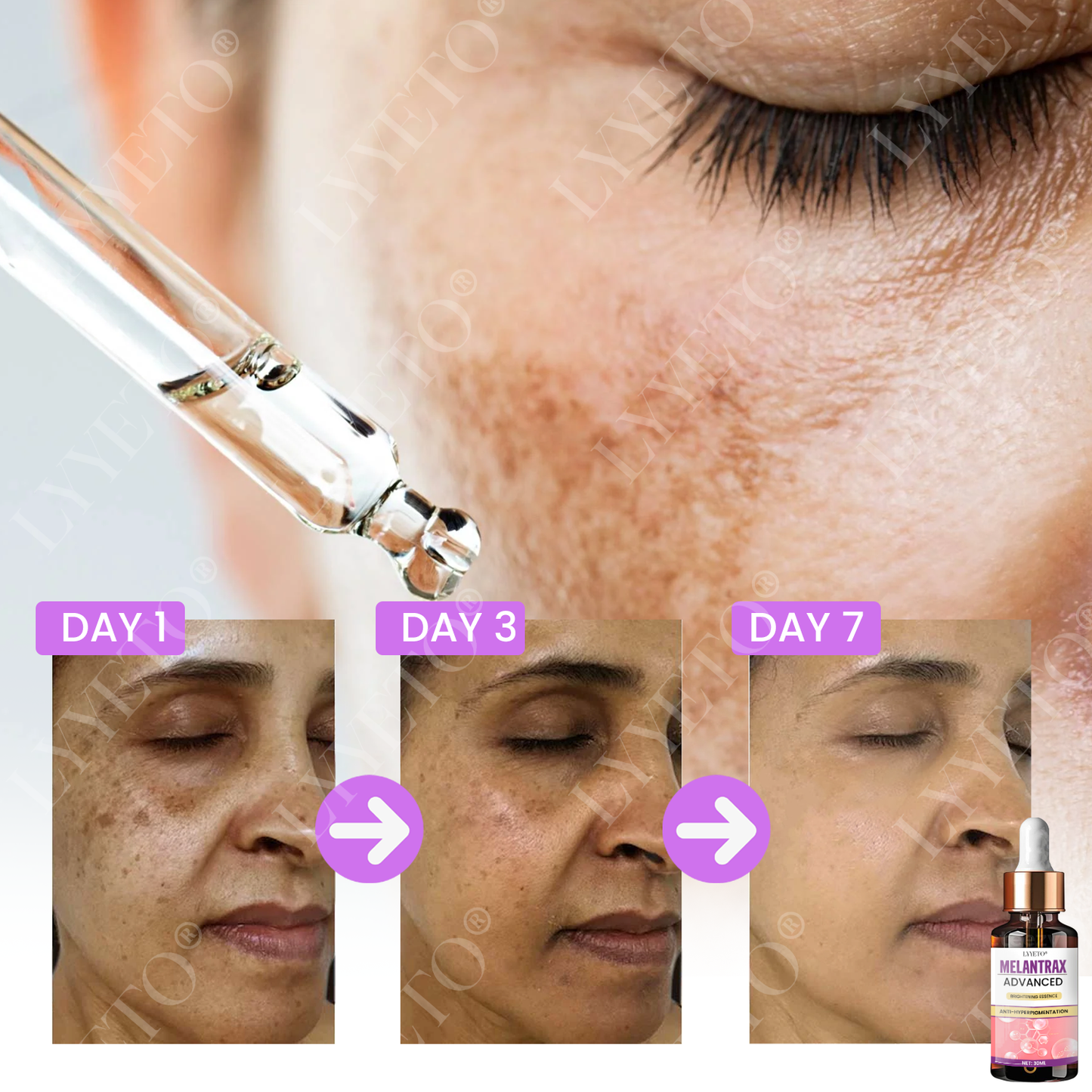 Προηγμένο Λευκαντικό Serum ACE