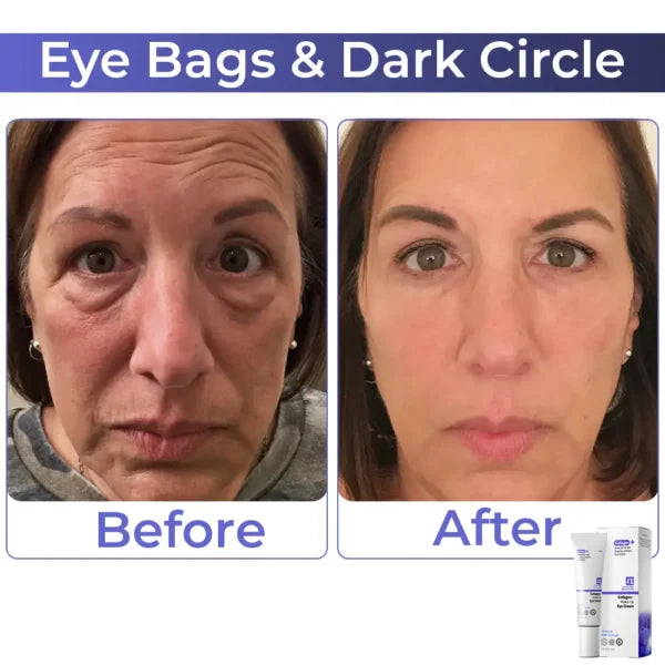 Κρέμα Ματιών Κολλαγόνου