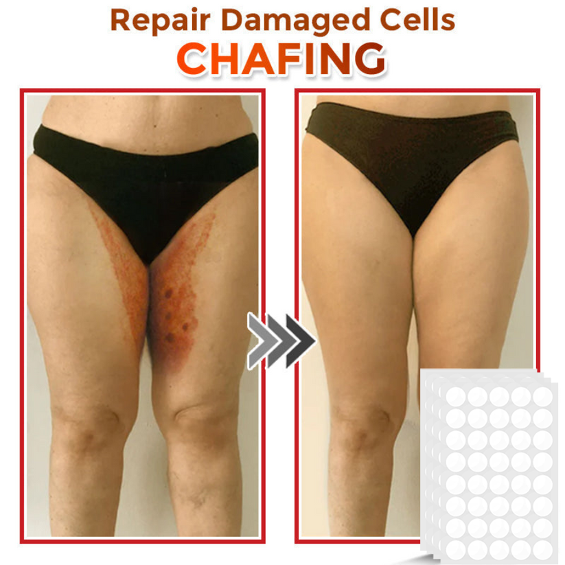 Φυτικά Έμπλαστρα Αφαίρεσης Θηλωμάτων